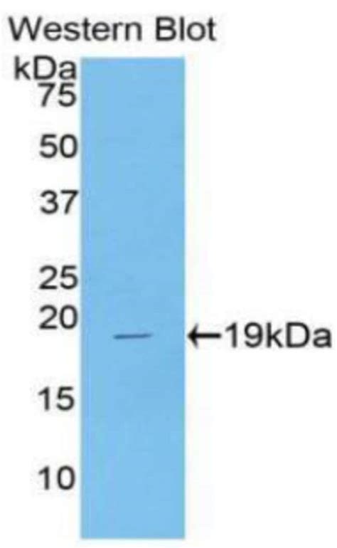 G Csf Polyclonal Antibody Invitrogen 100 μl Unconjugatedantibodies