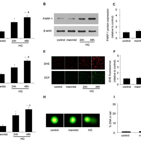 Myocardial Pathology Feature And PARP 1 Expression In Mice A PARP 1