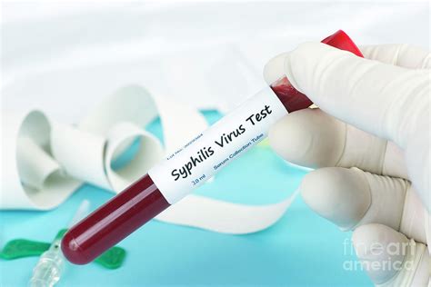 Syphilis Blood Test Photograph By Sherry Yates Youngscience Photo