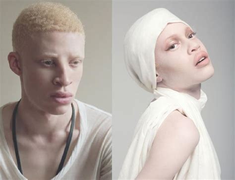 50 Shades Of White: The Beauty Of Albino People - GirlsAskGuys