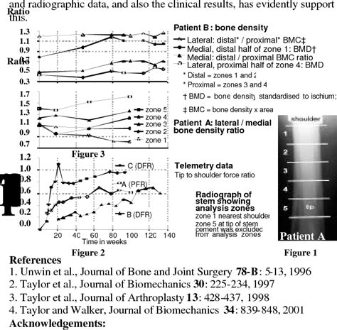 Figure 1 From A Novel Method For Early Detection Of Aseptic Loosening In Massive Implants A