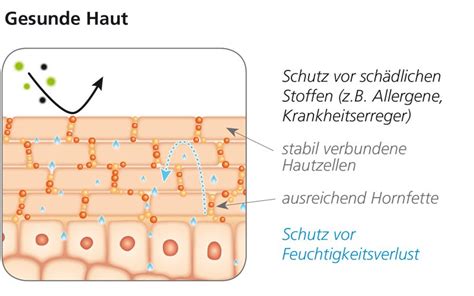 Neurodermitis de Ratgeber Bilder Therapieübersicht