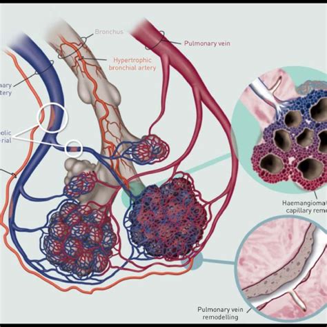 Pulmonary Artery Histology