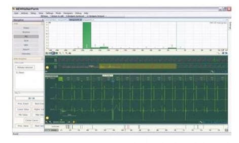 Btl Btl Cardiopoint Holter H Sw Systemy Holterowskie Ekg Medipment Pl