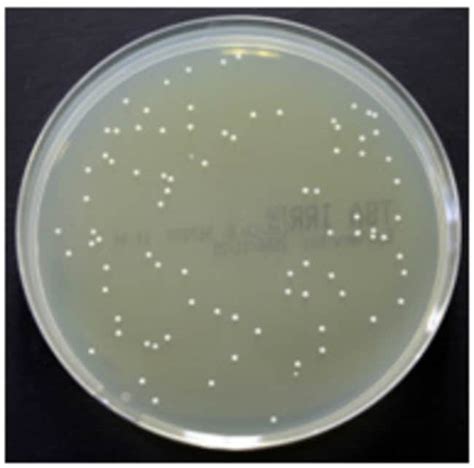 Thermo Scientific Tryptone Soya Agar Twi Deep Fillmicrobiological