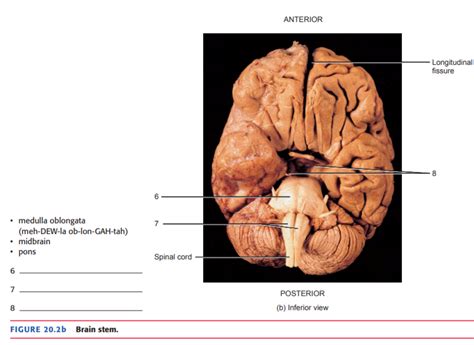 [Solved] SUPERIOR POSTERIOR ANTERIOR Superior colliculus Inferior ...