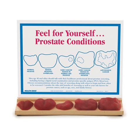 The Prostate Gland Chart