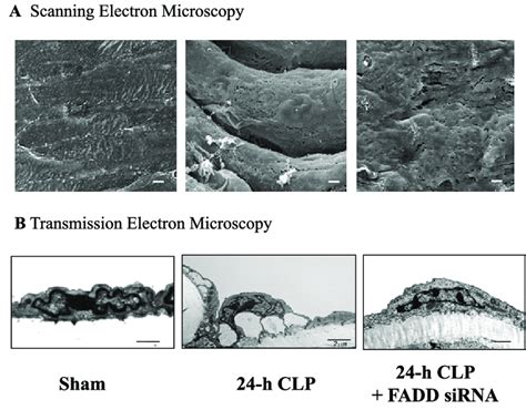 Electron Microscopic Analysis Of Mouse Aortic Endothelial Cells