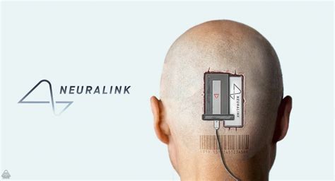 NAUKA | Elon Musk's Neuralink implants brain chip in first human