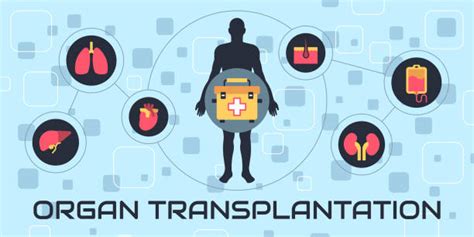 Organ Transplant Illustrations Royalty Free Vector Graphics And Clip Art