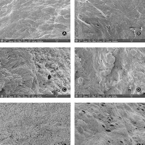 Biocompatibility Evaluation Of Different Substrates Including Bone