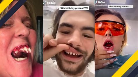 The 15 Worst Trends That Started On TikTok Wtf Gallery EBaum S World