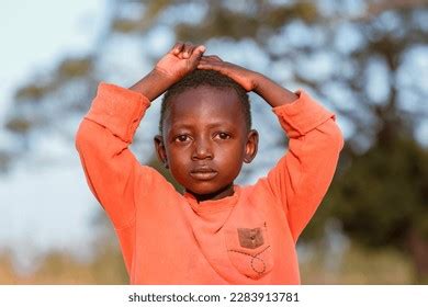 532 Malnutrition African Childs Images, Stock Photos & Vectors ...