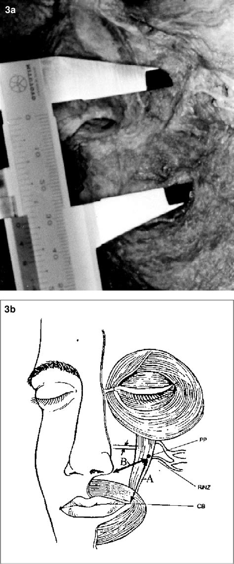 Figure From Estudo Anat Mico Do M Sculo Levantador Do L Bio Superior