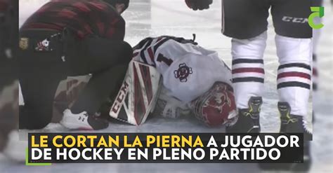 Le Cortan La Pierna A Jugador De Hockey En Pleno Partido