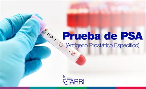 Prueba de PSA Antígeno Prostático Específico Química Tarri