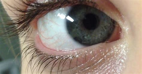 Can Someone Please Tell Me What Color My Friend S Eye Is We Can T Seem To Agree Imgur