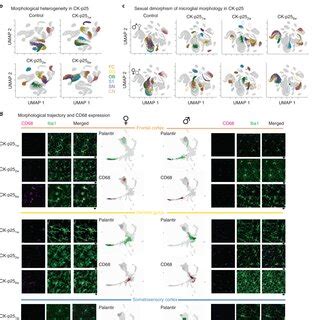 Microglia Phenotypic Spectrum In Xfad Transgenic Model Of