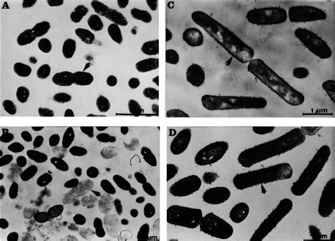 Transmission Electron Micrographs Of Cells Of Leuconostoc Mesenteroides