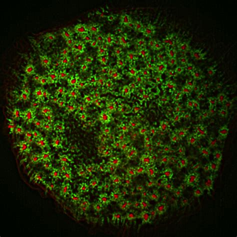 Podosome Mechanics Ipbs Toulouse