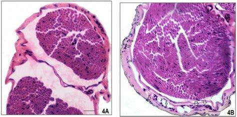 Photomicrograph Showing The Transverse Sections Of Left Sciatic Nerve