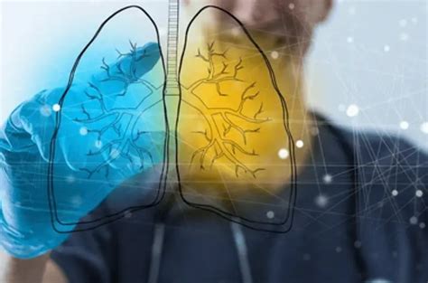 The Differences Between Copd And Asthma Medical Academic