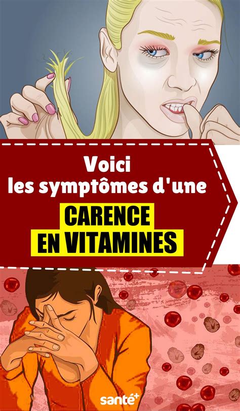 Voici Les Sympt Mes D Une Carence En Vitamines En Carence En