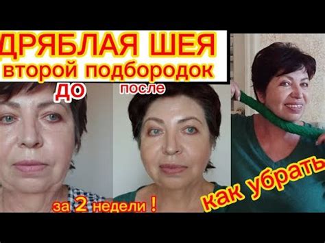 Как БЫСТРО ИЗБАВИТЬСЯ от ДРЯБЛОЙ ШЕИ и ВТОРОГО ПОДБОРОДКА!Просто Намочи ...