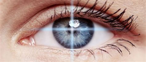 What To Expect After Laser Eye Surgery – Recovery Tips