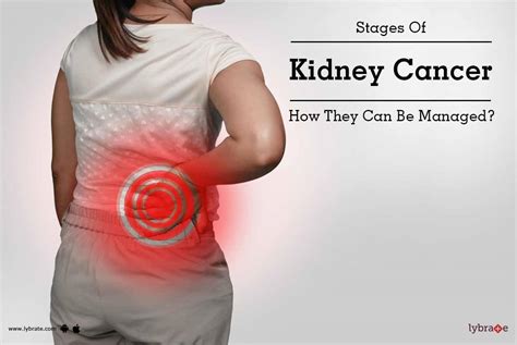 Stages Of Kidney Cancer - How They Can Be Managed? - By Dr. Mahendra ...