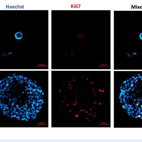 Granulosa Cell Proliferation Representative Confocal Microscopy Images