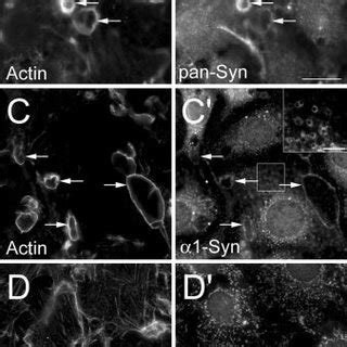 Tapp And Syntrophins Are Enriched In Pdgf Induced Dorsal Circular