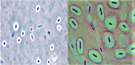 Capsule Staining Principle Methods Procedure Result Interpretation