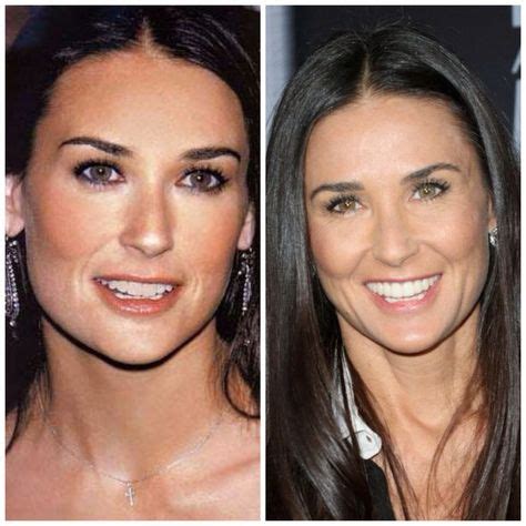 7 Demi Moore Plastic Surgery ideas | plastic surgery, demi moore, surgery