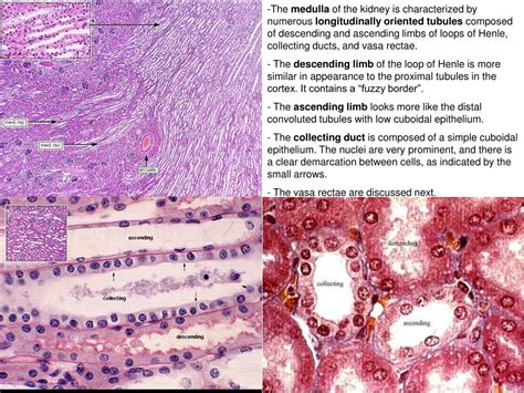 PPT - Renal Anatomy-Histology Correlate PowerPoint Presentation, free ...