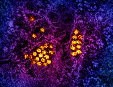 Dengue Virus Particles Transmission Electron Micrograph Of Flickr