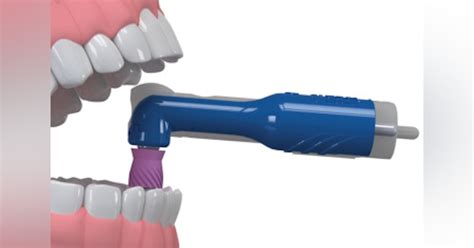 Young Introduces A New Handpiece And Prophy Angle Registered Dental