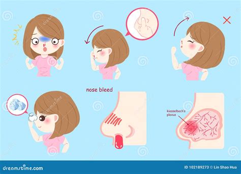 Nose Bleed Royalty-Free Cartoon | CartoonDealer.com #29839817