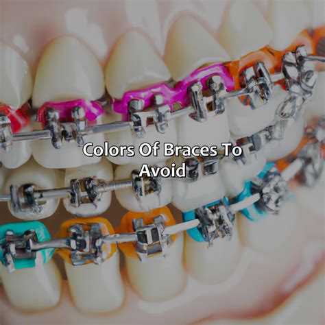 What Color Braces Make Your Teeth Look Whiter - colorscombo.com