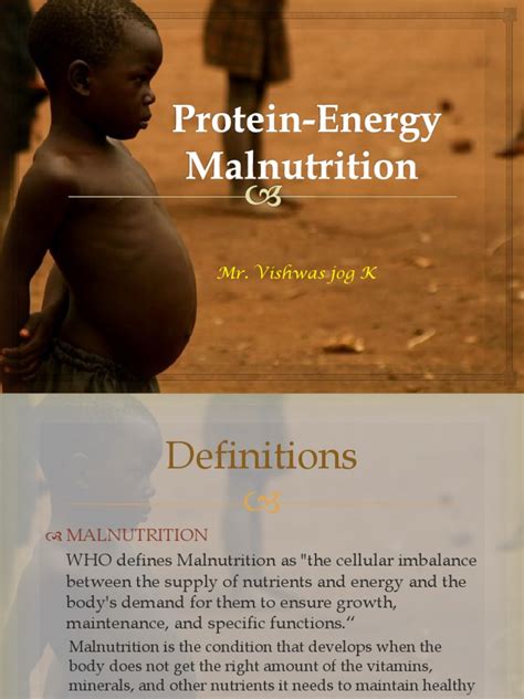 Protein Energy Malnutrition | Malnutrition | Nutrition