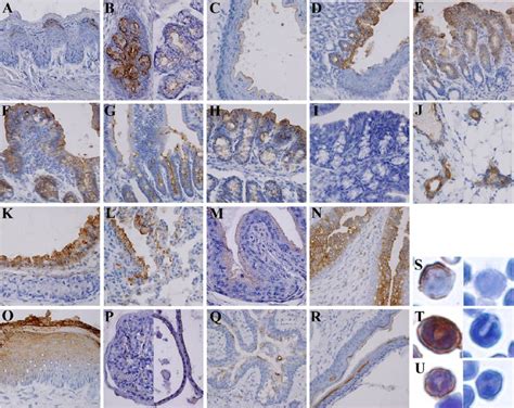 Patterns Of Tissue Expression From Immunohistochemistry All Sections