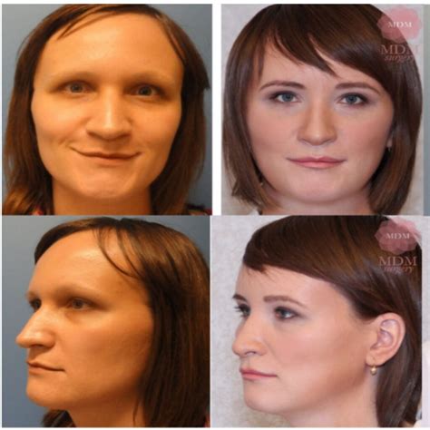 Aesthetic Facial Harmonization