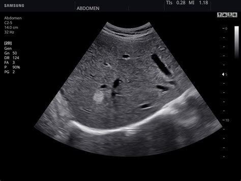 Ultrasound Images Liver B Mode Echogramm 847