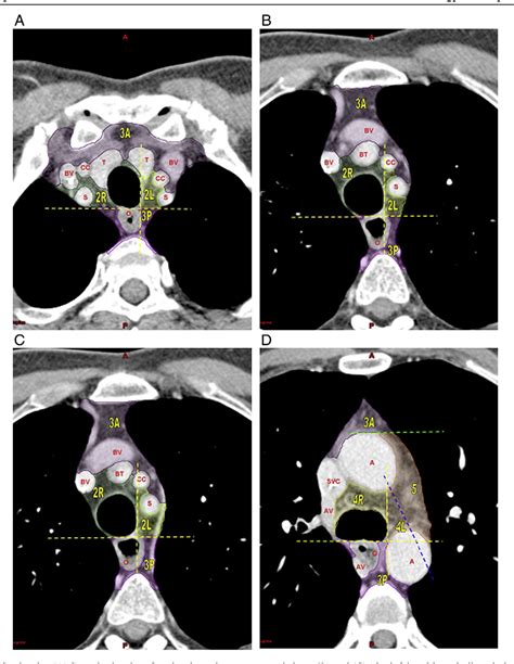 Figure 3 From Computed Tomographic Atlas For The New International