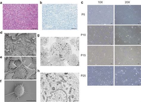 Establishment And Characterization Of A Novel Cell Line SCCOHT CH 1