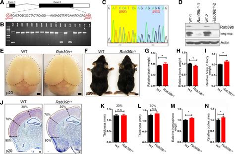 Figure 1 From Cerebral Organoid And Mouse Models Reveal A Rab39bpi3k