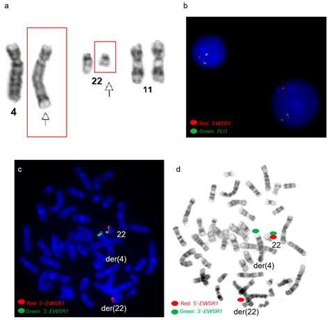 Genes Free Full Text Complexcryptic Ewsr1fli1erg Gene Fusions