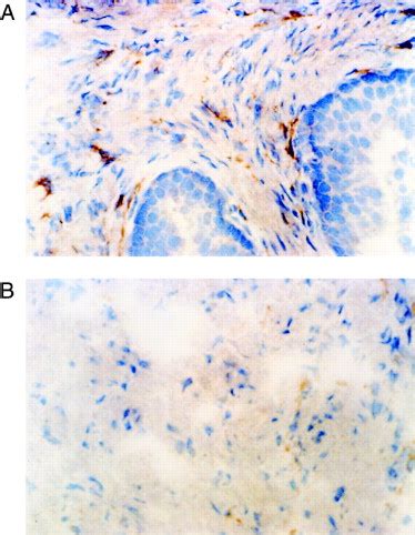 Interleukin 1α Is a Paracrine Inducer of FGF7 a Key Epithelial Growth