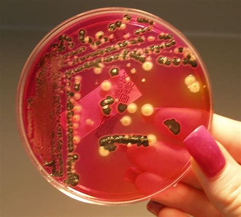 Salmonella On Xld Agar Plate Pics For Xld Agar Microbiology Medical