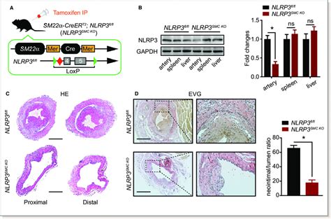 Smooth Muscle Specific Deletion Of Nlrp3 Attenuates Intimal